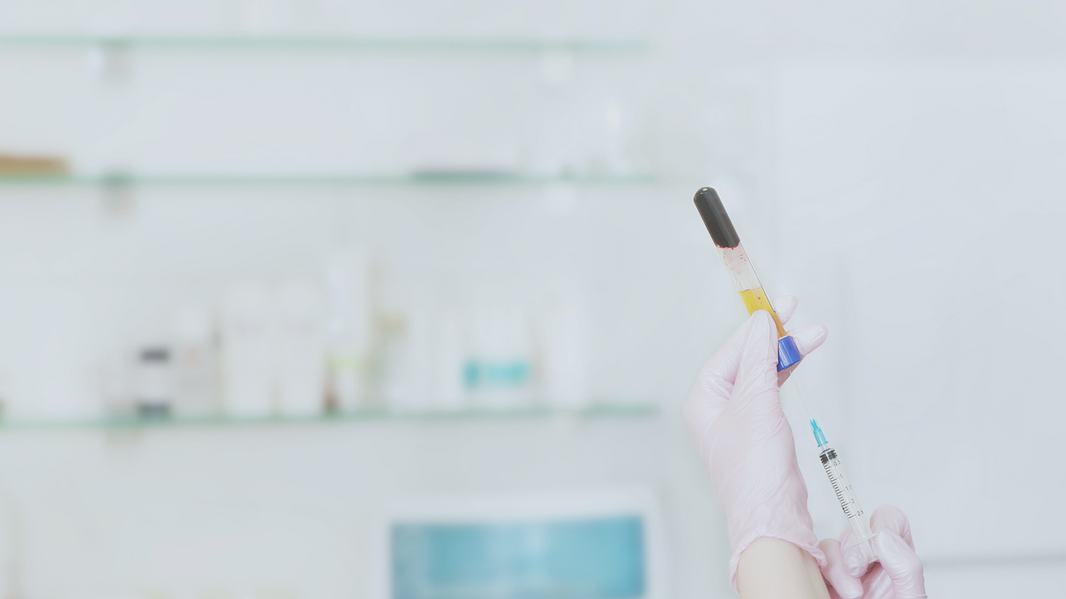 Platelet Rich Plasma (PRP) bei Kinderwunsch