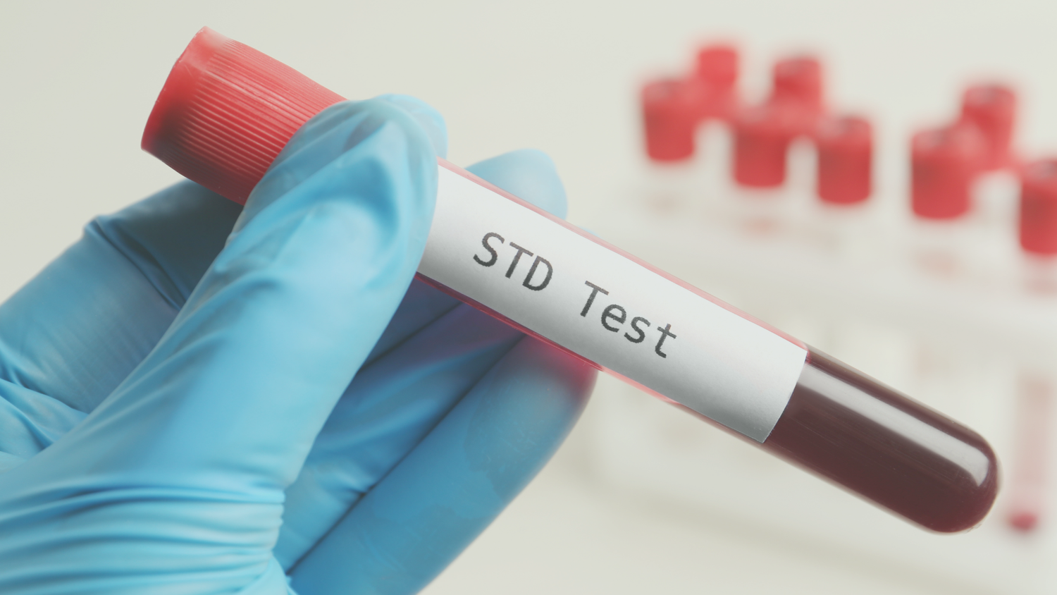 Sexuell übertragbare Infektionen (STDs) und ihre Auswirkungen auf Deine Fruchtbarkeit