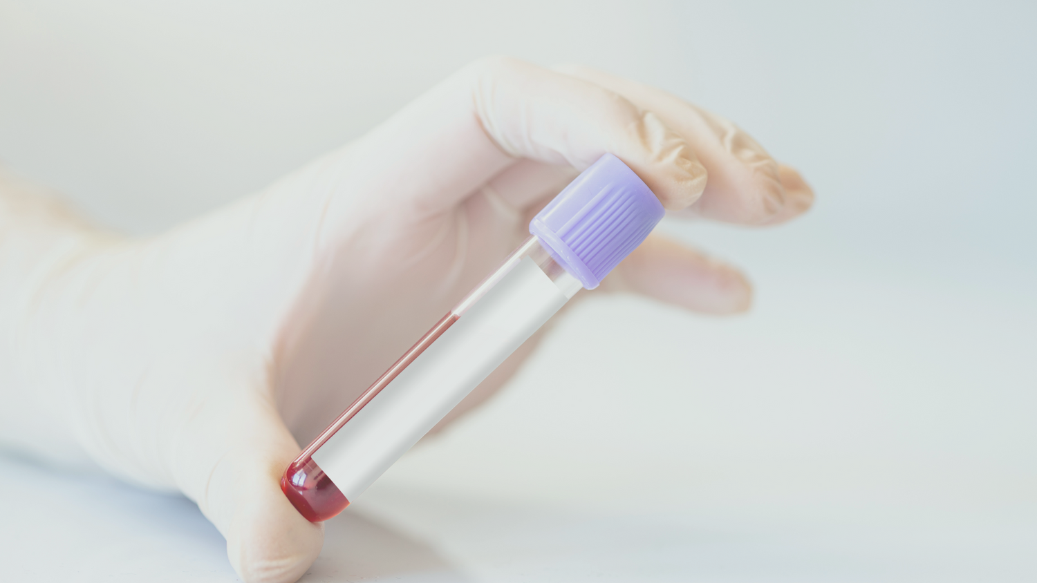 Fehlgeburten verstehen: Der niPOC Test